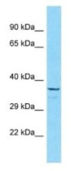 OR5B3 Rabbit anti-Human, Polyclonal, Novus Biologicals:Antibodies:Primary